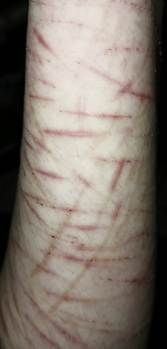 melankoliii___'s tweet photo. Wish they would never fade
Wish I wasn't so alone

SFX makeup practice for today, all are FAKE realistic drawings made with AI asistance
#slittwt #988twt #selfharm https://t.co/OfojofbS5u