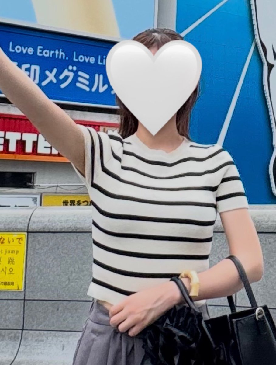 bh__kyun's tweet photo. 二の腕の脂肪吸引から2ヶ月経ちました！
術前は二の腕を気にしてなかなか着れなかった洋服も考えずに着れるようになりました♪
傷跡はほぼわからない状態なので周りの人にバレてません☺️こんなに綺麗な二の腕にしていただけて嬉しいです🤍

#レアート #ソ院長 https://t.co/2LL5aI1lf3