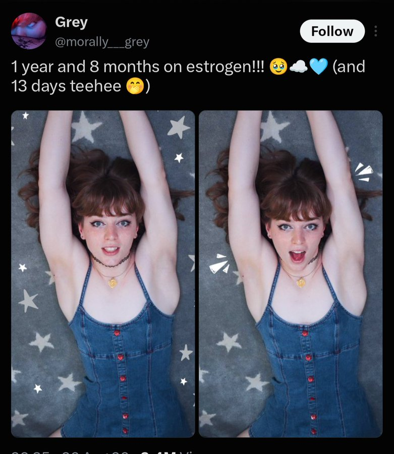 Muslim_Bomni's tweet photo. @morally___grey Yeah I mean you have naturally broad shoulders and innately masculine biceps, triceps, deltoids, etc https://t.co/g6MndpvWLx