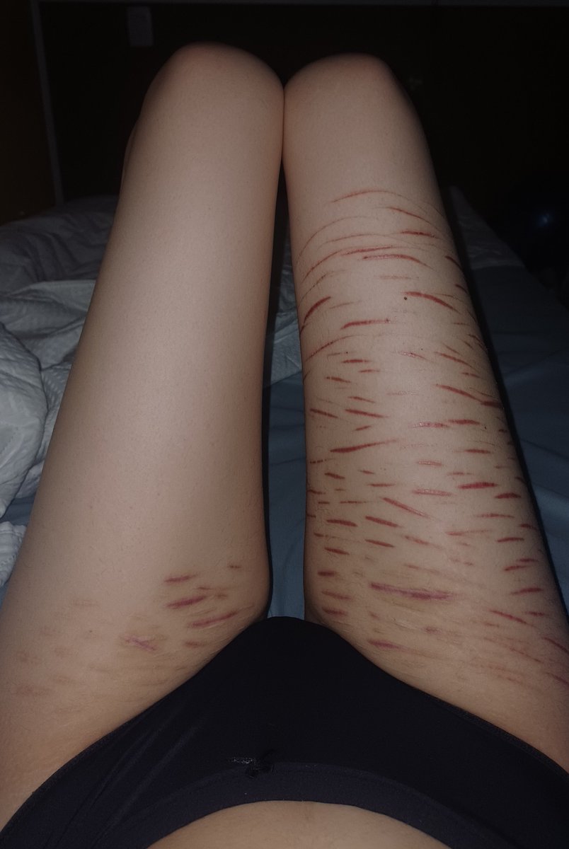 MothOfTheShed's tweet photo. Can anyone compliment me? Im feeling really down 🥲🥲🥲
Yes I know I need to fill in the gaps of my sh, its also bothering me

#edtwt #shtwt https://t.co/GJ9G8ABIIh