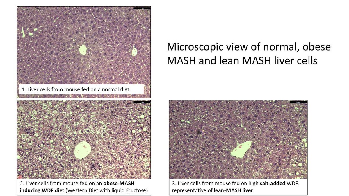dukenus's tweet photo. New Duke-NUS research finds excess salt may drive fatty liver disease (lean MASH) via its own distinct mechanism, hinting at why obesity-based treatments fall short in lean patients.
Read the full story here: https://t.co/1ycZ7Xf2ez
📸: Duke-NUS
#DukeNUS #LiverHealth #MASH https://t.co/eAisn4qLxT