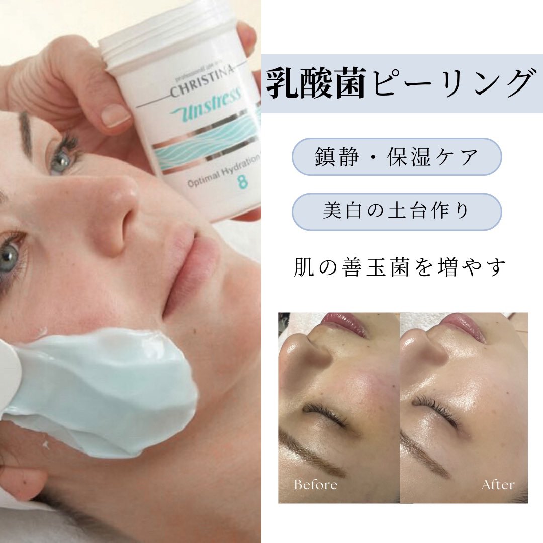 bebeaura_salon's tweet photo. 本日最終日🔔
乳酸菌ピーリング受けた方に3回分のアフターケアセットプレゼント🎁

☑︎乾燥・くすみを感じている方
☑︎水光肌になりたい方
☑︎秋花粉で肌が揺らいでいる

そんな方におすすめの肌管理🥼

本日数枠ご案内可能ですのでお早めに🤍 https://t.co/hHUbelNU05