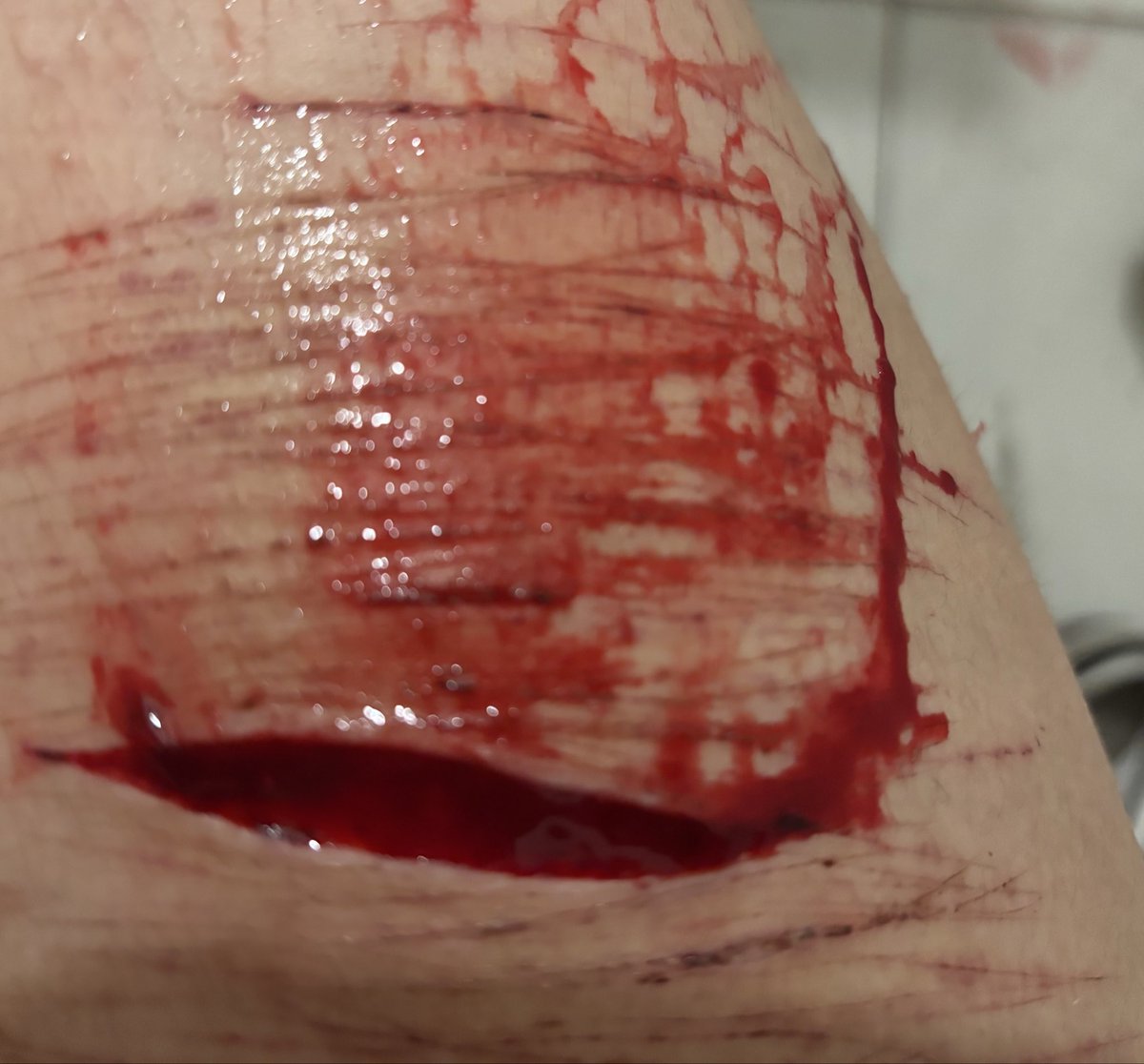 Shark_aryy's tweet photo. maquillaje para halloween, prueba de maquillaje 💗
#sh #selfharm #shtwtt #fakeblood #aisfxmakeup
#slittwt https://t.co/VZguuwRqJk