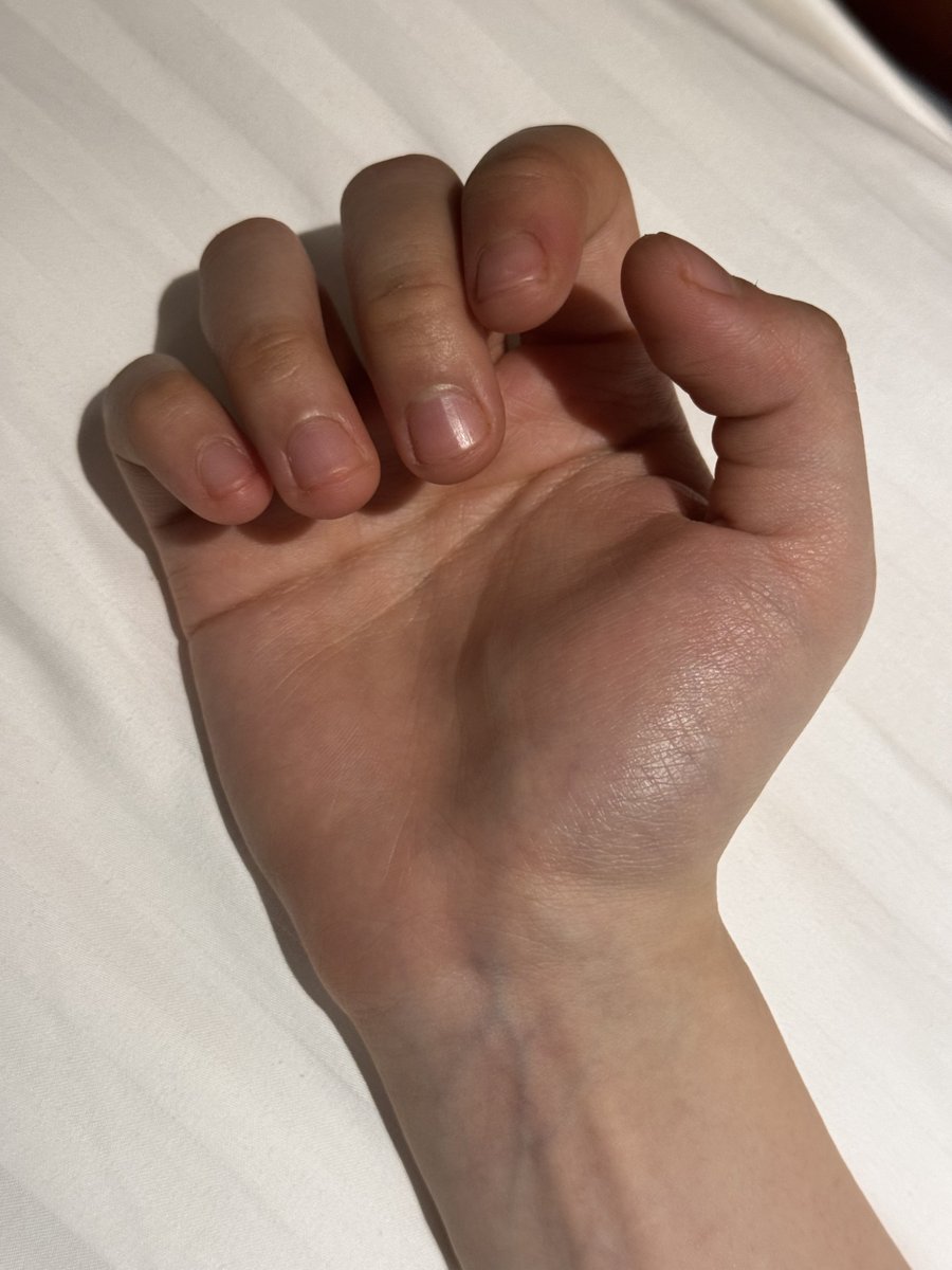 n0lkkj's tweet photo. 얼마전에 엄마지인분이 내 손 붙들고 여자애 손톱이 이게 뭐냐고 연장을 꼭 받아야한다고 안그럼 뭐가 어떻게 된다고 일장연설을 하셔서 전 그냥 손톱이 작게 태어난 건데요... 저희 아빠 손도 저랑 똑같이 생겼어요 라고 대답했는데 못 알아들으시는거임... 그럼 섹스는요 여자들 깁은 줘야죠 라고 https://t.co/p7CtYVf4eW