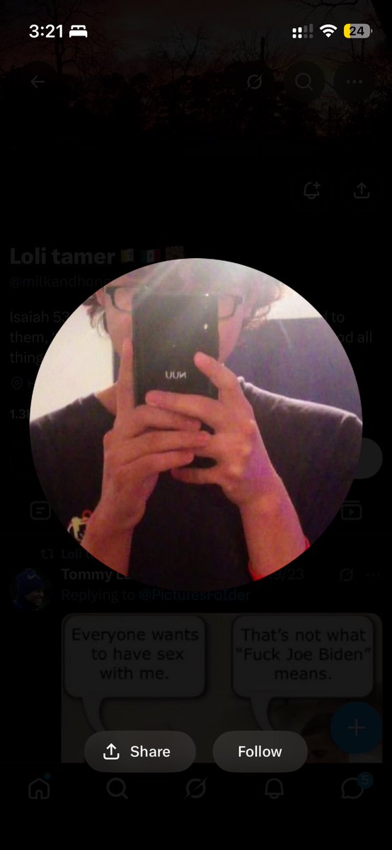 thoughts866174's tweet photo. @777asana777 @Zephyrncva @Waterxzy This’ me without! A bloated face! https://t.co/yFQQTt4zTw