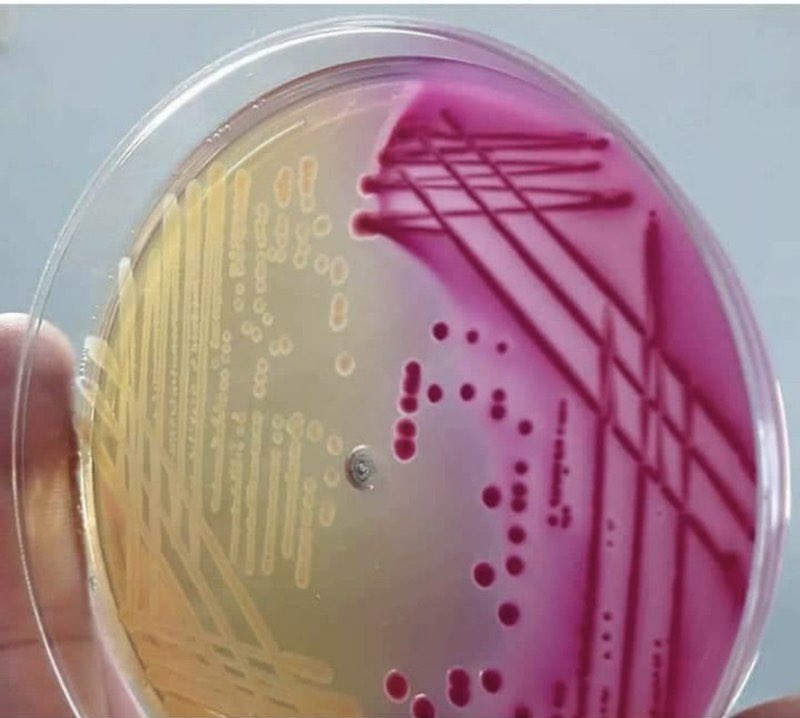 _Rose_Lab's tweet photo. للطلاب المقبلين على ��ختبار الهيئة
#SLLE  &amp; #Micro 
🦠MacConky Agar 
selective media 
اختياريه اي انها تسمح للبكتيريا السالبه بالنمو ولا تسمح للبكتيريا الموجبه بالنمو 
diffrential media 
بيئةً تفريقه اي انها تفرق بين البكتيرياlactose fermention والبكتيريا  non lactose fermentation https://t.co/6fFyMQBCLl