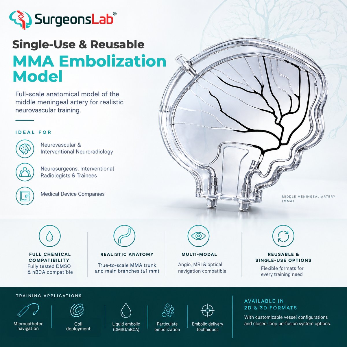 SurgeonsLab's tweet photo. Glue or Onyx? Coils or particles? How distal is distal enough?
 
MMA embolization is everywhere in neurointervention right now, and good operators still disagree on how to do it. What nobody disputes is that it's a small, tortuous vessel with very little room for error.
 
So we built a model for it. True-to-scale MMA trunk and branches, validated with DMSO and nBCA, angio-ready, in 2D and 3D, single-use or reusable, with an optional closed-loop perfusion setup. Navigate, coil, glue, inject particles, then do it again.
 
For fellows, for experienced operators trying something new, and for device teams who need consistent anatomy.
 
Want one for your course or lab? Send us a message.
 
#MMAembolization #Neurointervention #Neurosurgery #MedicalSimulation #MedTech #SurgeonsLab