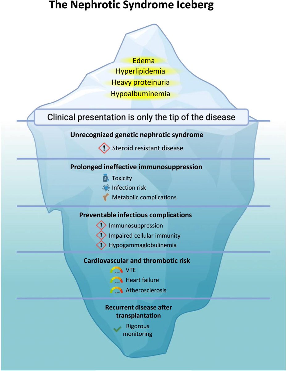 edgarvlermamd's tweet photo. Ten tips for the diagnosis and management of nephrotic syndrome ca. 2026 from @CKJsocial 
#Nephpearls

👉🏼 https://t.co/8hJYAltBTh https://t.co/aXD2jQgUTn