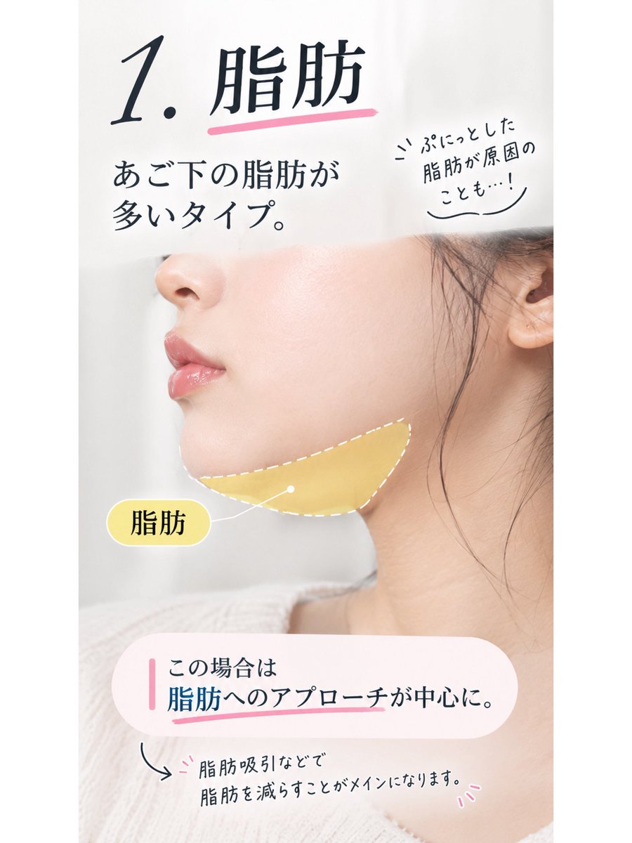 INDIBA_OnpaLabo's tweet photo. 「二重顎＝脂肪」だと思ってない？

実はここ、かなり重要です。

脂肪を取っても二重顎が残る場合、
原因は脂肪以外にある可能性も。

✔︎ あご下の脂肪
✔︎ 広頸筋のゆるみ
✔︎ 皮膚のたるみ

二重顎は「脂肪の量」だけで決まるわけではありません。 https://t.co/zh8qhjFN57