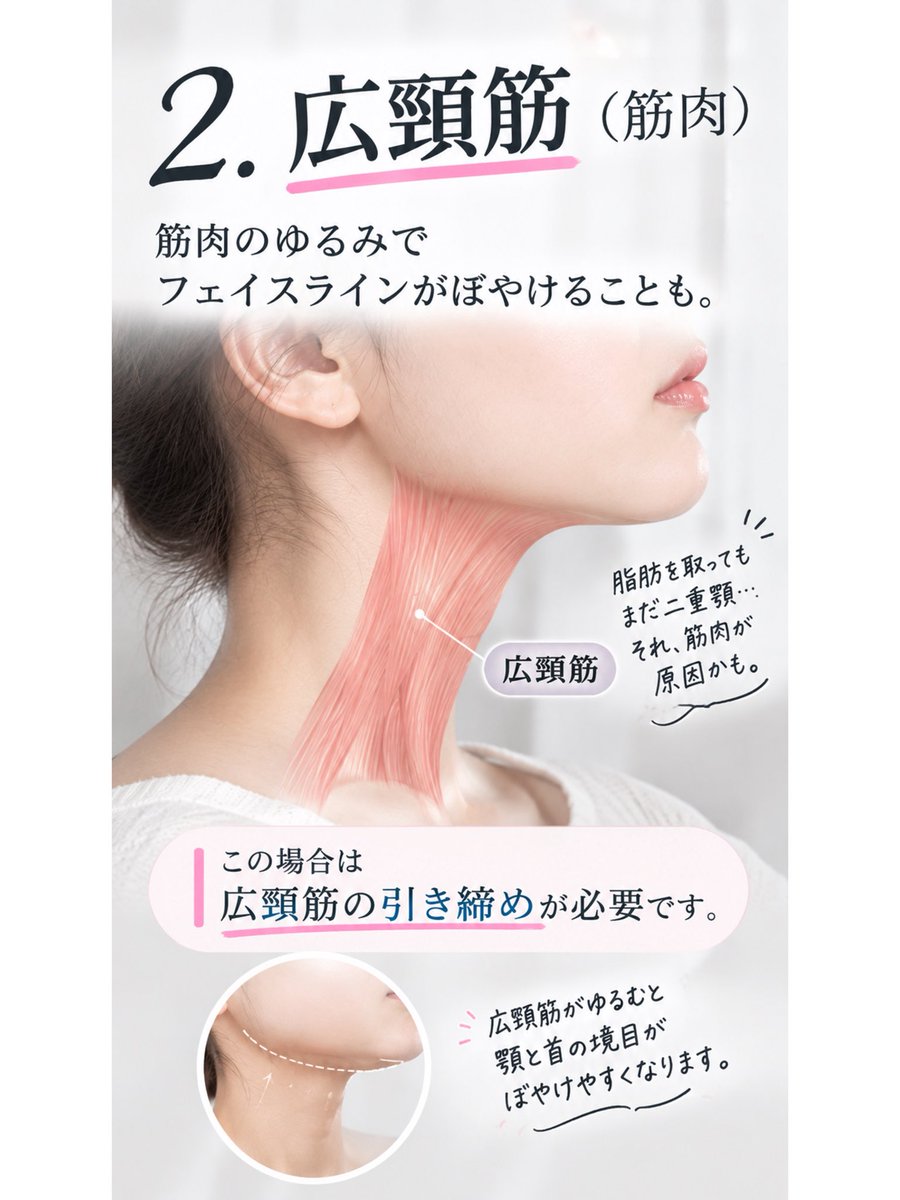 INDIBA_OnpaLabo's tweet photo. 「二重顎＝脂肪」だと思ってない？

実はここ、かなり重要です。

脂肪を取っても二重顎が残る場合、
原因は脂肪以外にある可能性も。

✔︎ あご下の脂肪
✔︎ 広頸筋のゆるみ
✔︎ 皮膚のたるみ

二重顎は「脂肪の量」だけで決まるわけではありません。 https://t.co/zh8qhjFN57