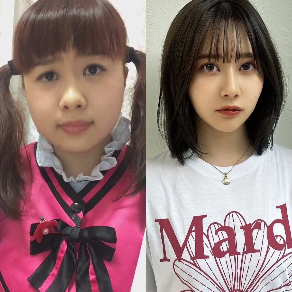 4bj2db's tweet photo. エミリンのビフォアフやばいwwww『マンジャロより痩せる』ってガチじゃん。 https://t.co/3MG1ElNLLm