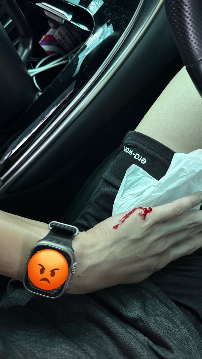 fforcejs's tweet photo. อ้วมอิสัสแมวนรกเลียมือกูดีๆกัดกูซะงั้น 
กะจะซื้อเปียกแมวให้ซะหน่อยไม่ต้องกินแม่งละ ! https://t.co/8pz907Logb