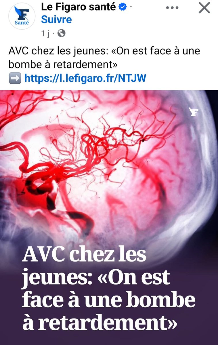 AgretDenis's tweet photo. L'incidence des AVC chez 20-54 ans a presque doublé aux USA. Ca viendra en France. 
Pourquoi ?...
Les vaccins pédiatriques et covid causent des vascularites coronaires (maladie de Kawasaki) et aussi cérébrales, de l'hypertension artérielle (maladie de Takayasu) et des anévrismes...
Voilà pourquoi l'obligation vaccinale 2018 buzyn + covid 2021 ne va faire qu'aggraver la santé de la population française et la mortalité cardiovasculaire chez les jeunes...
Il est urgent d'arrêter ce massacre et d’en parler sérieusement.