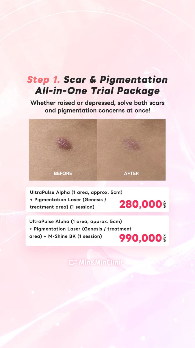 Minandmin_en's tweet photo. Want to erase scars &amp; pigmentation with massive October savings? 💫

Get up to 50% OFF + an extra 10% OFF for companion visits with our October All-in-One Event! Starting at a special price of 280,000 KRW~.

#MinAndMinClinic #MinAndMinScarLab #UltraPulse #ScarRemoval https://t.co/rVh8GUjxqr