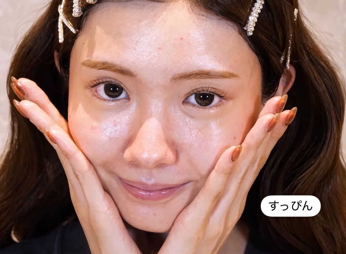 rin3ten's tweet photo. 【悲報】ひめかのすっぴん、公開される

トップキャバ嬢のひめかでも鼻翼基部の陥没はこれくらいあるし、ニキビ跡や色素沈着も普通にあるし、眉下切開したけど予定外重瞼線（三重）も残っている。

貴族手術やリジュランでガチガチ港区武装する訳でもなく、キャバ嬢にしても珍しい歳のとり方だと思う https://t.co/gq41JfCp3c