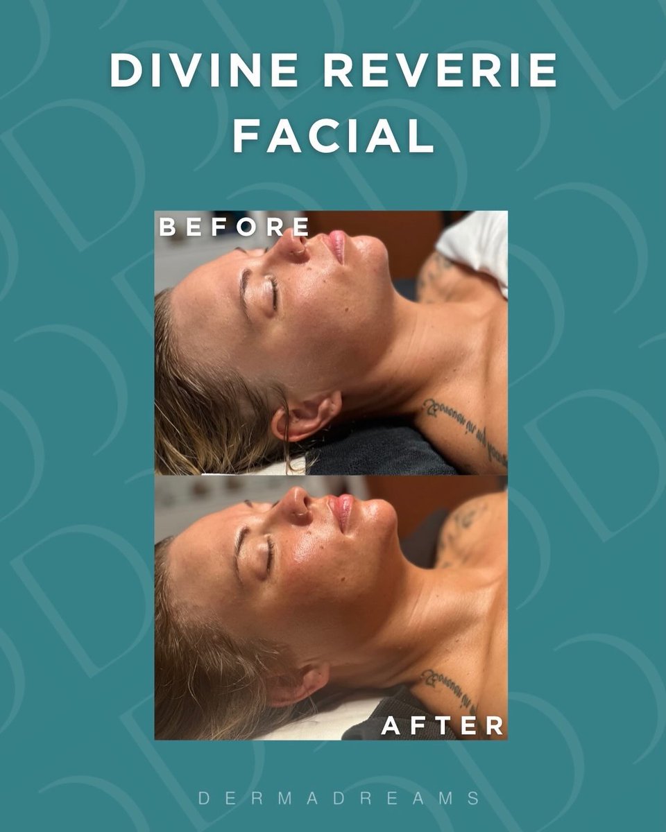 dasytheonly's tweet photo. Indulge in the ultimate self-care experience with our Divine Reverie Facial. Customized for radiant skin with a double cleanse, skin analysis, fruit enzyme peel, and more. Treat yourself to pure bliss today. https://t.co/SZkWJ1GwbD