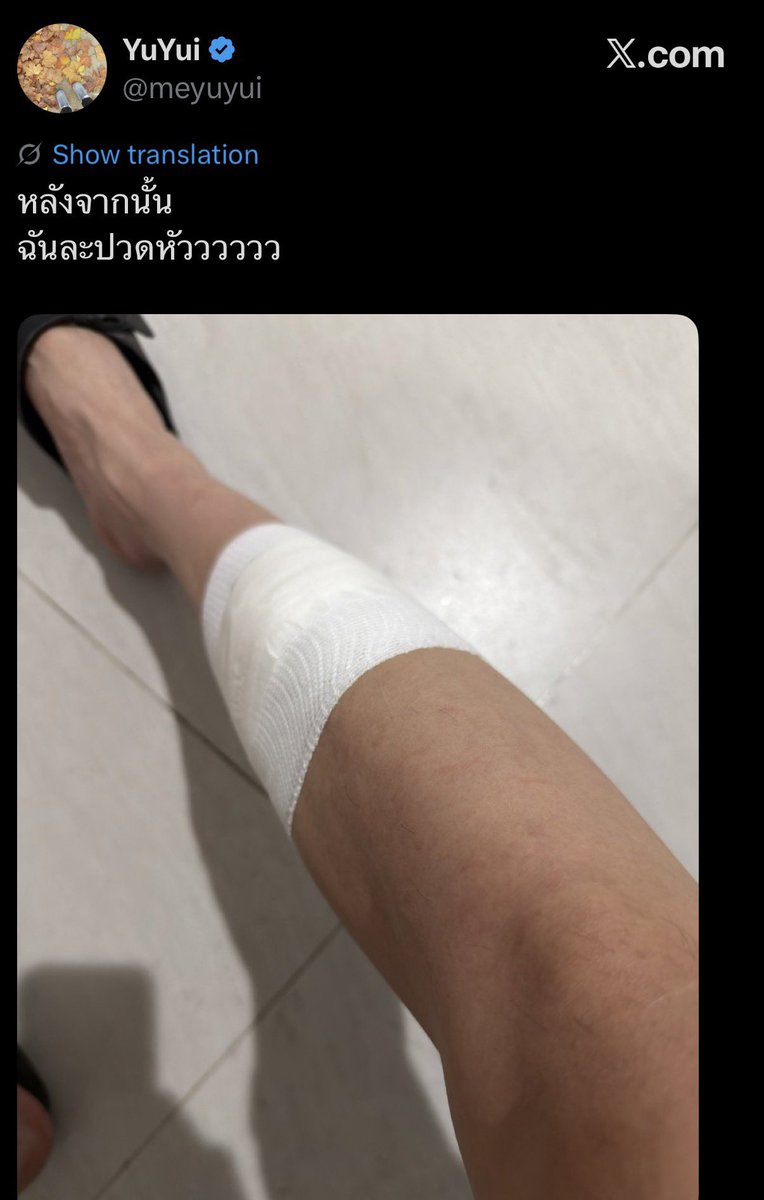 Aumeu's tweet photo. ฉันเป็นแม่ยุ้ย ฉันไมเกรนขึ้นอะ ดูลูกแต่ละคน คนนึงแมวกัด คนนึงเตะเหล็ก เลือดตกยางออกกันหมด 5555555555555555
#forcebook https://t.co/LaTt60hM6o