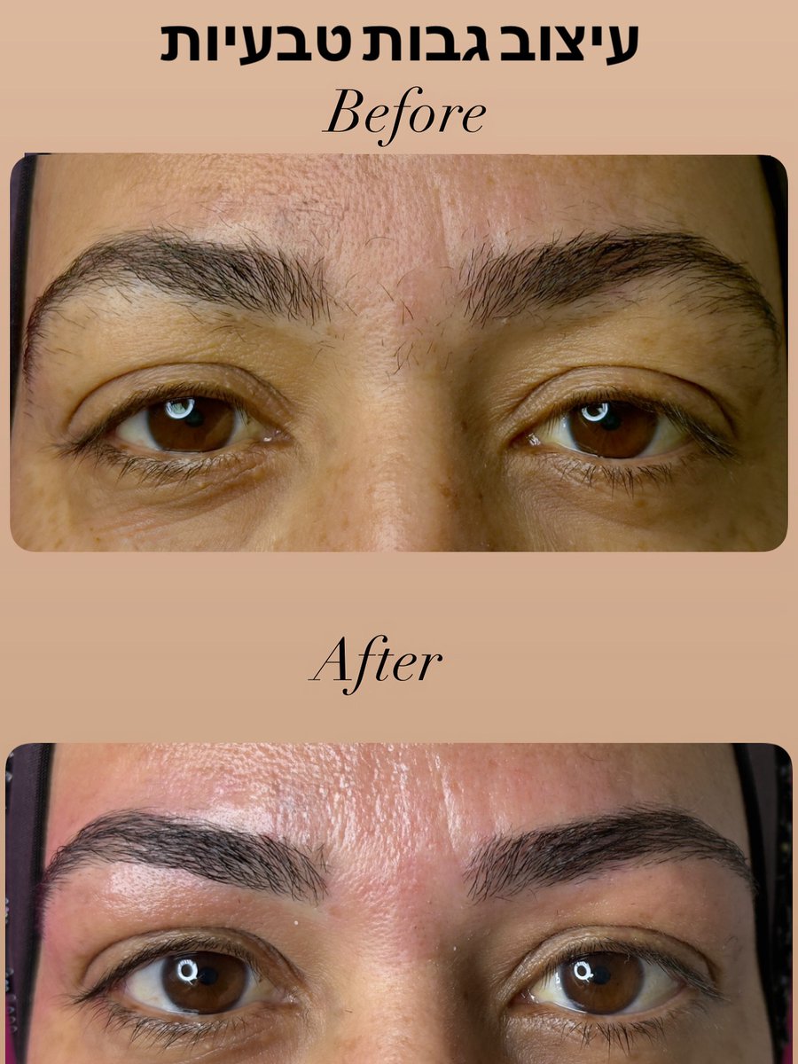 SEVELINA5000's tweet photo. A client came to me after one eyebrow was thinned out elsewhere. She received a detailed explanation of the restoration process and guidance on filling in her eyebrow for the time being. https://t.co/w0UI4Qi5Y7