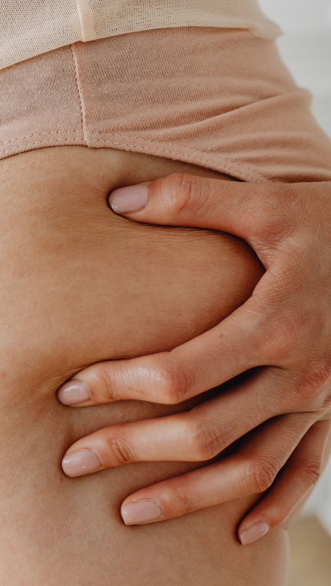 420xNO2's tweet photo. LIPEDEMA

Lipedema is real, painful, and many women don’t know they have it. Awareness is the first step toward treatment. Book your free appointment, and we’ll take care of your condition. https://t.co/1Dk8gLpCm4