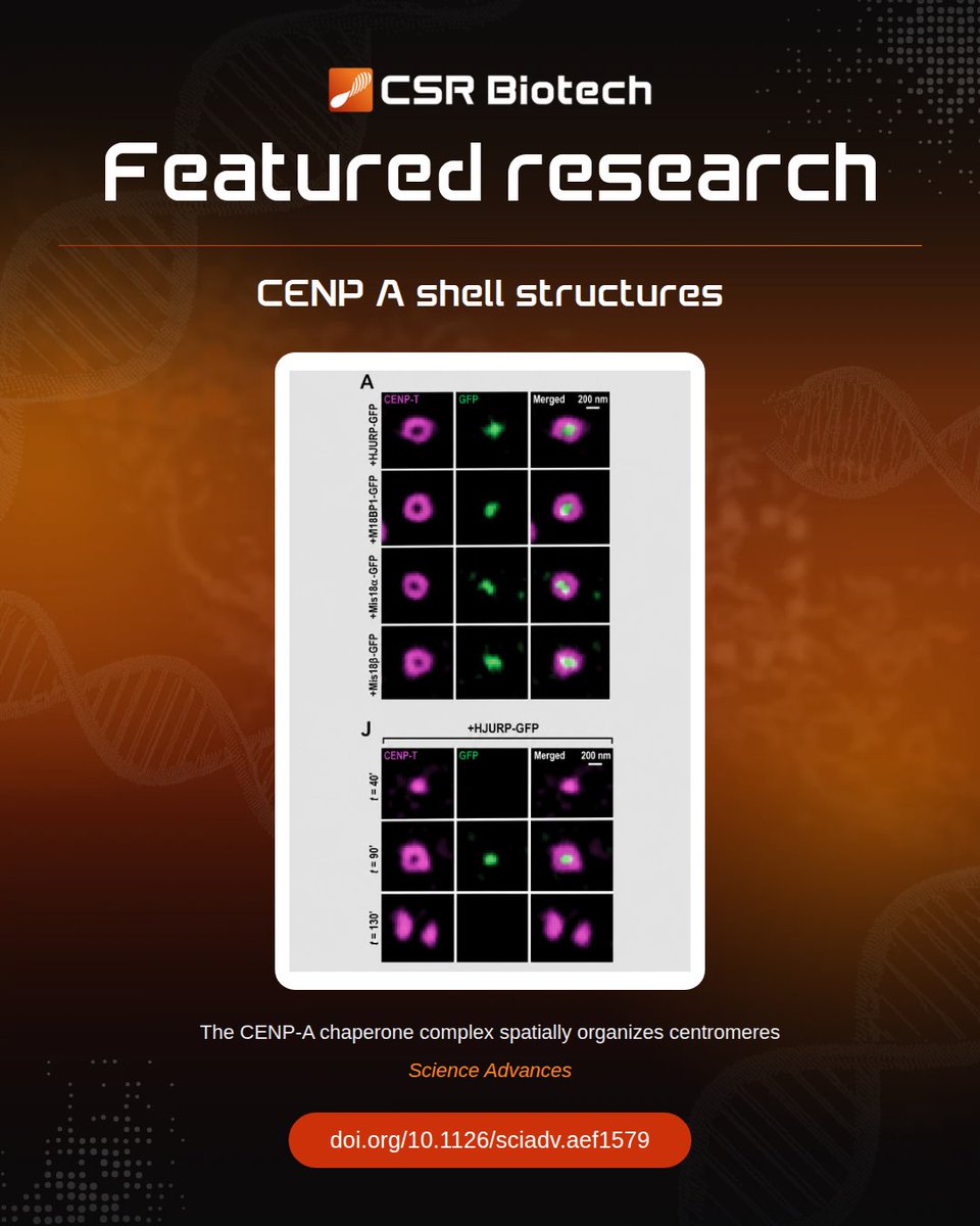 CSRBiotech's tweet photo. A recent research published in Science Advances, by Alexander E. Kelly’s team at NIH reveals an unrecognized structural role for the CENP-A chaperone machinery.
" Hessian 3D-SIM  images were acquired using a Cell Xtreme microscope from CSR Biotech."
https://t.co/0nEwbawnQy https://t.co/fRg1p6IDWr