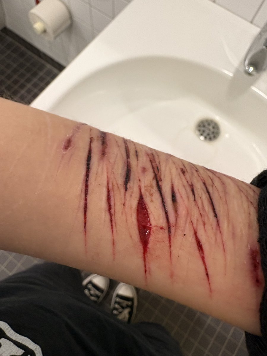 4t3rg's tweet photo. Sfx makeup I’ve done yesterday night, somebody tell me what layer of skin this is (sfx makeup all fake not real fake blood) https://t.co/iorKmsy07w