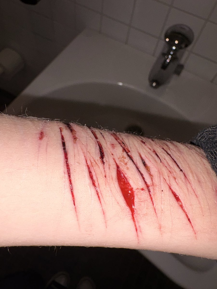 4t3rg's tweet photo. Sfx makeup I’ve done yesterday night, somebody tell me what layer of skin this is (sfx makeup all fake not real fake blood) https://t.co/iorKmsy07w