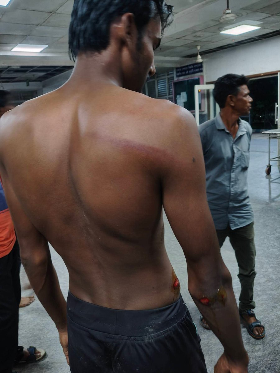 HinduVoice_in's tweet photo. Shocking news coming in from #Birbhum district of #WestBengal. 

In #Jolundigram village under the jurisdiction of #Nanur Police Station, some goons who claimed as BJP workers, attacked a Shakha of RSS.

RSS workers are mercilessly beaten by self-claimed BJP workers. 

Several RSS members are injured. 

The incident happened on the evening of 29 September, 2026.