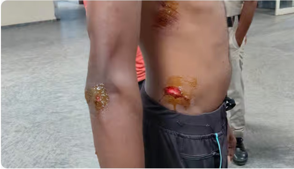HinduVoice_in's tweet photo. Shocking news coming in from #Birbhum district of #WestBengal. 

In #Jolundigram village under the jurisdiction of #Nanur Police Station, some goons who claimed as BJP workers, attacked a Shakha of RSS.

RSS workers are mercilessly beaten by self-claimed BJP workers. 

Several RSS members are injured. 

The incident happened on the evening of 29 September, 2026.