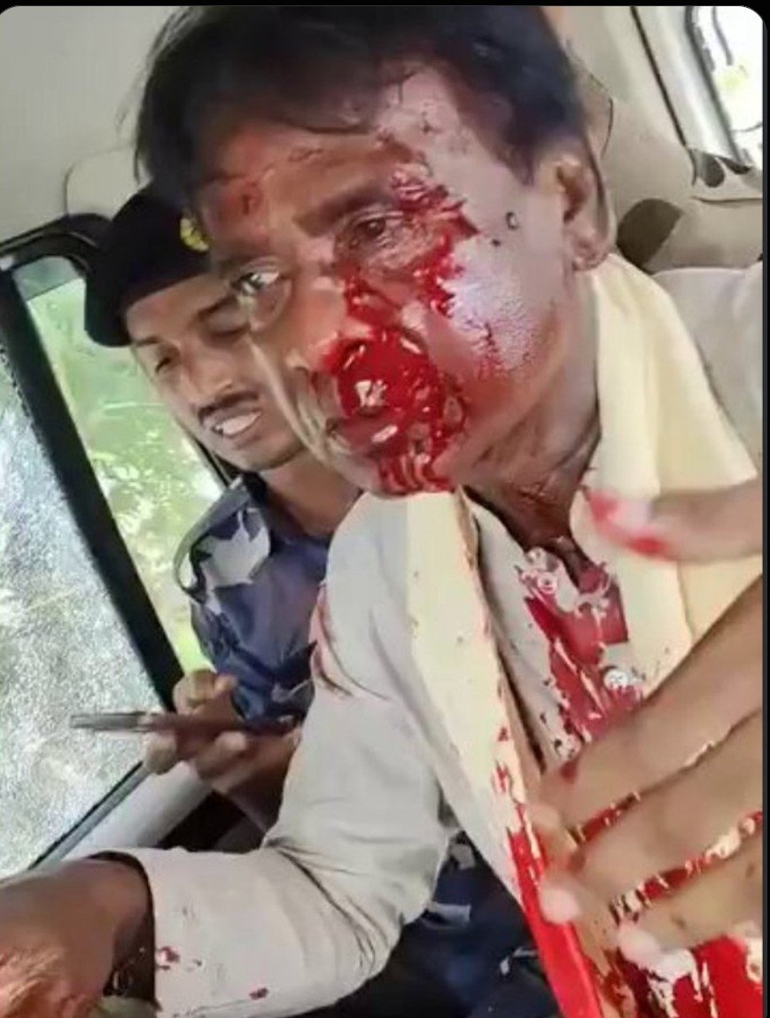 DasShib35530's tweet photo. @SabirAl72017365 Egulo ki tor Babar Kirti tai chup kore chhili? https://t.co/gYb9dzUUQk