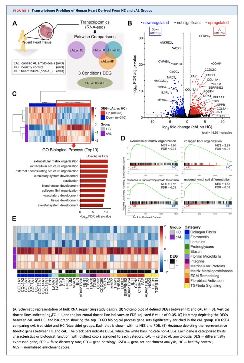 Myeloma_Doc's tweet photo. #Myeloma Paper of the Day: Transcriptome analysis of AL #amyloidosis pt myocardial samples finds upregulation of fibroblast activation genes (e.g. collagen type I/III & periostin), fibroblast-to-myofibroblast transition in vitro & matrix remodeling: https://t.co/re73ymwdq3. #alsm https://t.co/R4Fj3m0eGs