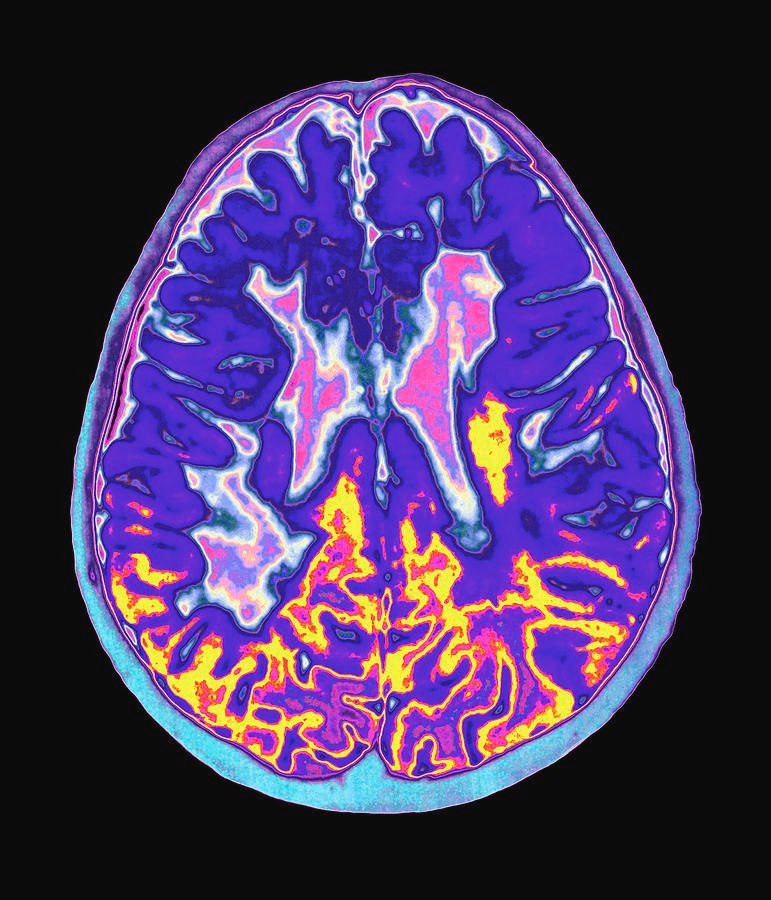 NightSkyToday's tweet photo. JUST IN🚨: A research reveals that while the human brain can remember insults for 20 years, it can only retain compliments in the mind for about 30 days. https://t.co/jAIF6mdVx7