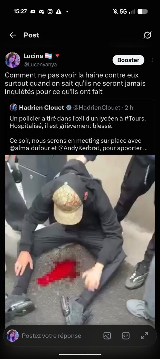 Lucenyanya's tweet photo. Le nombre de gens prêt à justifier de mutiler des enfants sous chacun des posts qui parle des violences policières, c'est une vraie dinguerie d'avoir aussi peu d'empathie https://t.co/DhRkeiJVJj