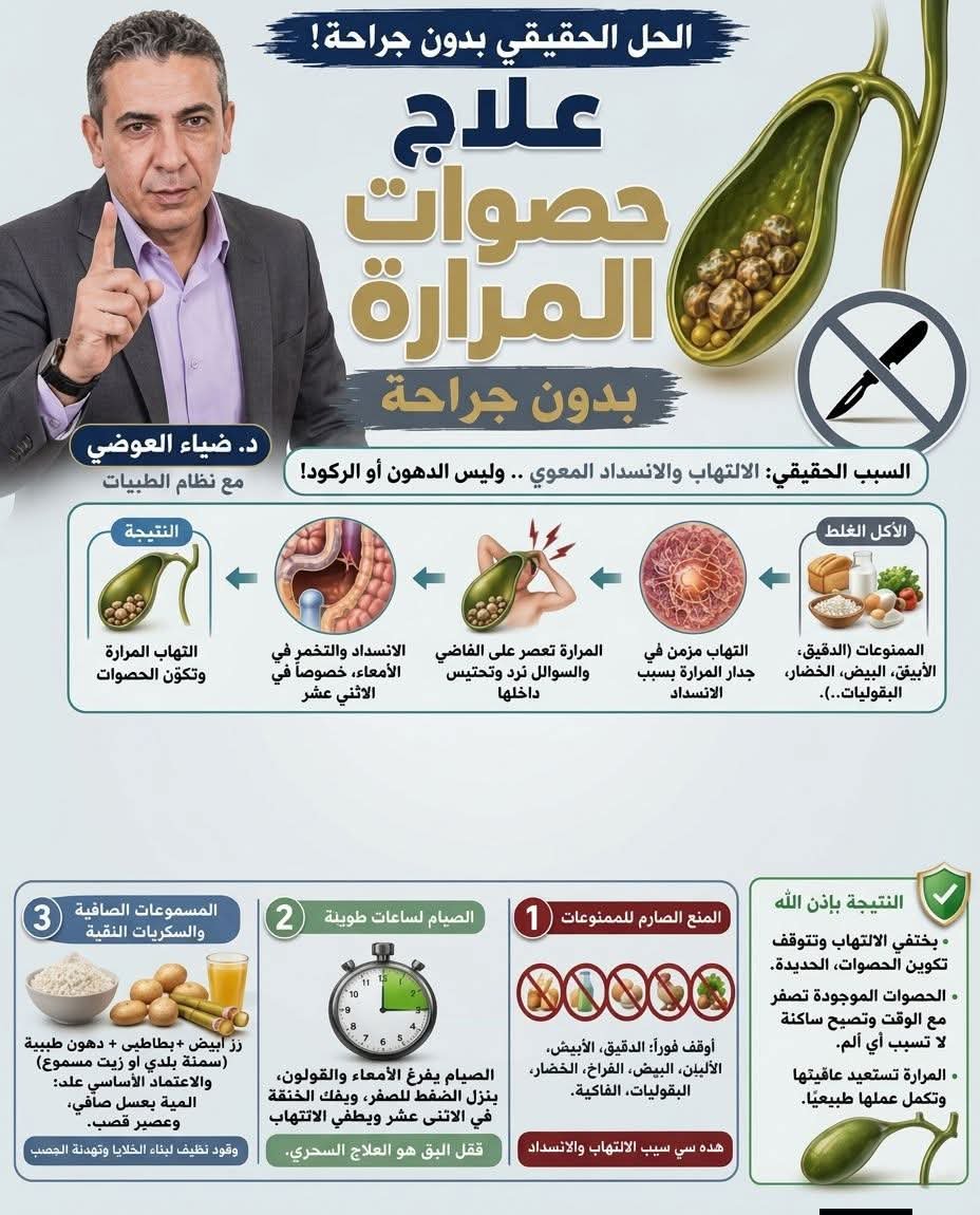 AliAli137278's tweet photo. دكتور ضياء العوضي في نظام الطيبات بينسف تماماً الفكرة التقليدية للطب عن حصوات المرارة وأسبابها وعلاجها. 
الطب التقليدي بيقنعك إن الحصوات دي بتيجي من أكل الدهون، أو بسبب إن المريض كان وزنه زايد وخس بسرعة فالدهون اتحشرت، أو بسبب ركود السائل المراري. لكن دكتور ضياء بيسخر من الكلام ده وبيأكد إن الحصوات مش بتيجي من الركود، دي بتيجي في الأساس بسبب "الالتهاب والانسداد المعوي".

دكتور ضياء بيشرح الآلية بمنتهى الدقة؛ لما حضرتك بتاكل أكل غلط من الممنوعات (زي المعجنات، العيش، الجبنة البيضاء، الخضار، والبقوليات)، الأكل ده مابيتهضمش كويس وبيعمل انسدادات وتخمر في الأمعاء، وتحديداً في منطقة "الاثنى عشر". المنطقة دي هي نفس الفتحة اللي المرارة والبنكرياس بيصبوا فيها إفرازاتهم عشان يهضموا الأكل. فلما المرارة تيجي تعصر وتنزل السائل المراري بتاعها، تلاقي السكة مسدودة قدامها بكتلة من العجين أو الألياف، فالإفرازات دي بترد تاني وتتحبس جواها. 

المرارة بتقعد "تحزق" وتعصر على الفاضي، والسائل المحبوس ده بيعمل التهاب مزمن في جدار المرارة. الالتهاب ده بينتج عنه خلايا ميتة وبقايا بروتين، ودي بتبقى عاملة زي "النواة" أو البؤرة اللي بتبدأ الأملاح (زي الكوليسترول أو غيره) تترسب وتتبلور حواليها، وتتكون الحصوة. يعني الحصوة أساسها التهاب مش مجرد أملاح زادت. وكمان الدكتور بيوضح إن الوجع الشديد اللي حضرتك بتحس بيه في الجنب اليمين بعد الأكل، غالباً مبيكونش من المرارة نفسها، ده بيكون من "ثنية القولون" (الركنة اليمين) اللي تحت الكبد مباشرة، اللي اتنفخت بالغازات والفضلات وضغطت على المكان ده.

بالنسبة للعلاج حسب نظام الطيبات، فالموضوع بعيد تماماً عن فكرة الجراحة. دكتور ضياء بيرفض تماماً استئصال المرارة بحجة إن فيها حصوات، وبيقول نصاً "ماتشيلش حاجة ربنا خلقها، انت اتخلقت بأمانات لازم تسلمها سليمة زي ما هي". العلاج الجذري بيكون بإزالة السبب الأساسي للالتهاب والانسداد، وبيمشي على الخطوات دي بالتفصيل:

أولاً: المنع الصارم لكل الممنوعات، لازم حضرتك توقف فوراً الأكل اللي بيسد الاثنى عشر وبيعمل التهاب، وتمنع تماماً (العيش والدقيق الأبيض بكل أنواعه، منتجات الألبان كلها، البيض، الفراخ، وكل أنواع الخضار والفاكهة). دي الحاجات اللي بتعمل المطبخ الفاسد جوه بطنك.

ثانياً: "الصيام" لساعات طويلة، الصيام هنا هو العلاج السحري اللي بيفضي الأمعاء والقولون، وبينزل ضغط البطن للصفر، وبيفك الخنقة والانسداد اللي عند الاثنى عشر، فساعتها المرارة بترتاح والالتهاب بيقف تماماً.

ثالثاً: الاعتماد على "المسموحات الصافية" زيرو فضلات، تاكل وجبات مقننة من الرز الأبيض والبطاطس (ومسموح تاكل معاها دهون عادية وتطبخها بسمنة بلدي أو زيت مسموح لأن المشكلة عمرها ما كانت في الدهون). وتعتمد بشكل أساسي على "السكريات النقية" (زي المية بعسل أبيض صافي وعصير القصب). 

بمجرد ما حضرتك تلتزم بالنظام ده، الالتهاب اللي في نسيج المرارة هيطفي، وعملية تكوين حصوات جديدة هتقف فوراً. أما الحصوات الموجودة بالفعل، فالدكتور بيأكد إن مع الوقت وحركة السوائل الطبيعية وغياب الالتهاب، الحصوة هتبدأ تصغر تدريجياً، وحتى لو فضلت موجودة فهي هتكون ساكنة ومش هتضرك ولا هتعمل لك أي مغص أو ألم، لأنك ببساطة شلت الضغط والالتهاب اللي كان مخليها تصرخ. ريح بطنك يا فندم، والمرارة هتسترد عافيتها وهتكمل بيها حياتك بدون أي عمليات.

تنبيه وإخلاء مسؤولية طبية وقانونية 
المحتوى الوارد أعلاه يمثل حصرياً وجهة نظر ورأي الدكتور ضياء العوضي وما يُعرف بـ "نظام الطيبات"، 

يرجى قراءة ما يلي بدقة:

تعارض مع المعايير الطبية: المعلومات المذكورة بخصوص أسباب تكون حصوات المرارة، وآلية عمل الجسم، وطرق العلاج المقترحة  تتعارض وتتناقض بشكل جذري مع الحقائق العلمية المستقرة، والممارسات الطبية المعتمدة عالمياً (Standard of Care)، والخطوط التوجيهية لجمعيات الجهاز الهضمي والجراحة حول العالم.

 لا يجوز بأي حال من الأحوال استخدام هذا النص كبديل للتشخيص الطبي، أو المشورة الطبية المهنية، أو العلاج من قبل طبيب متخصص ومصرح له بمزاولة المهنة. إن اتخاذ قرارات صحية، خاصة فيما يتعلق بوقف علاجات موصوفة أو إلغاء عمليات جراحية مقررة بناءً على هذا النص فقط، قد ينطوي على مخاطر صحية جسيمة ومضاعفات تهدد الحياة (مثل التهاب البنكرياس الحاد، انسداد القنوات المرارية، أو انفجار المرارة).

النظام الغذائي الموصوف (المنع الصارم لمجموعات غذائية أساسية) قد لا يناسب مرضى السكري أو أمراض أخرى، مما يتطلب إشرافاً طبياً دقيقاً وخبراء تغذية علاجيّة معتمدين