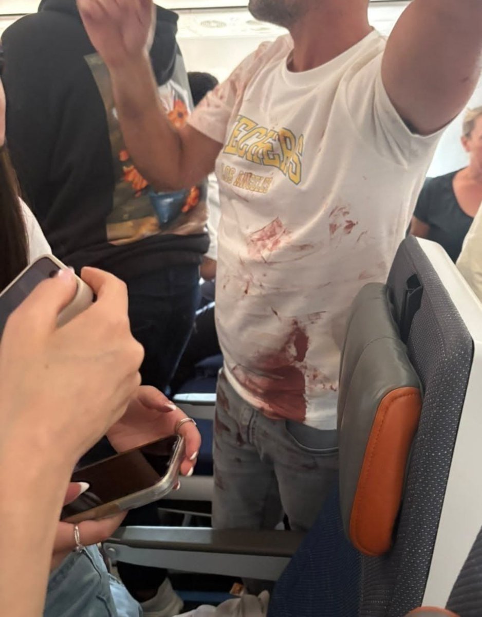 NoaMagid's tweet photo. Today could have become a day of mourning for us.

We had a great miracle on this plane.

Thank God. https://t.co/ETgCGBgulb
