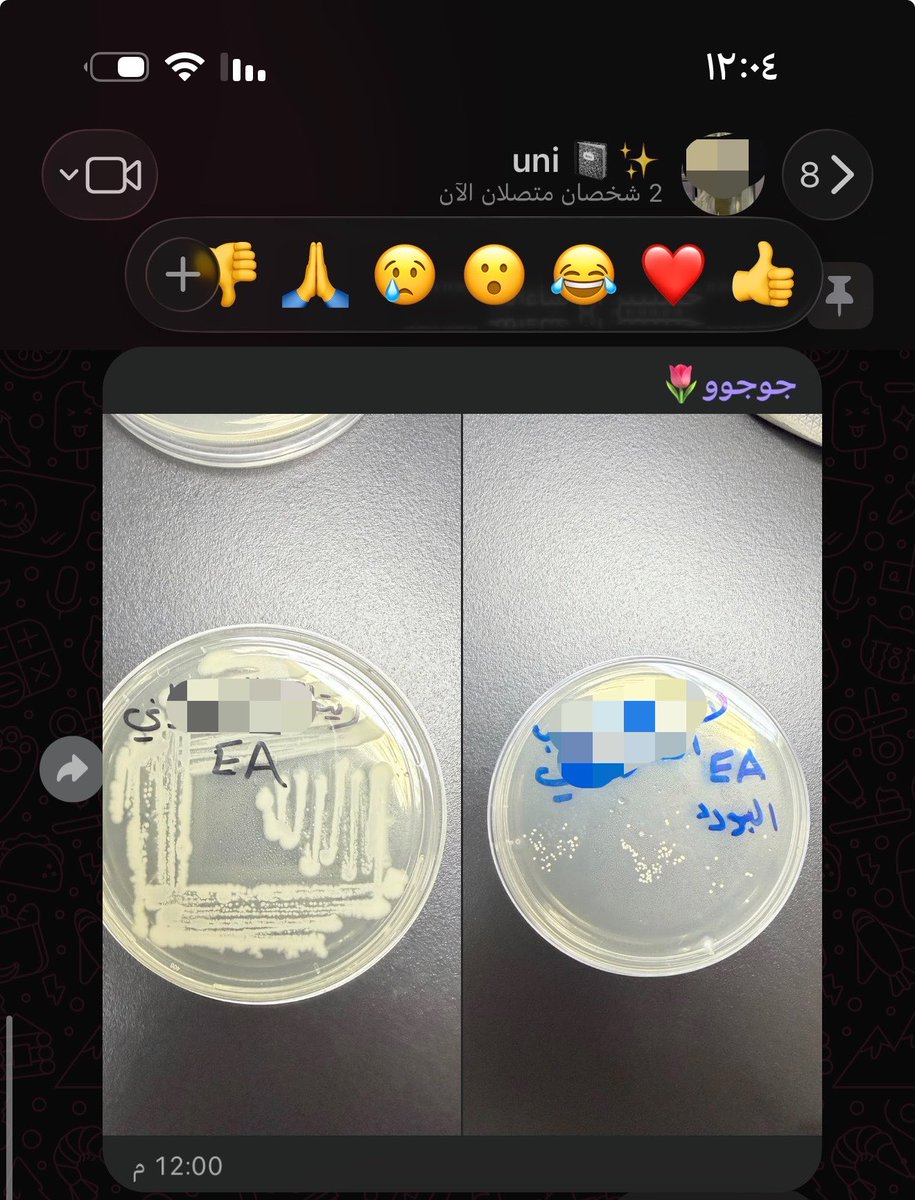 lonel7__'s tweet photo. نتائج لاب #Micro  
بخصوص اني مسويه قلب ببصماتي من البورد 
ويني ما اشوفه😕 https://t.co/jZHzqc5ZNd