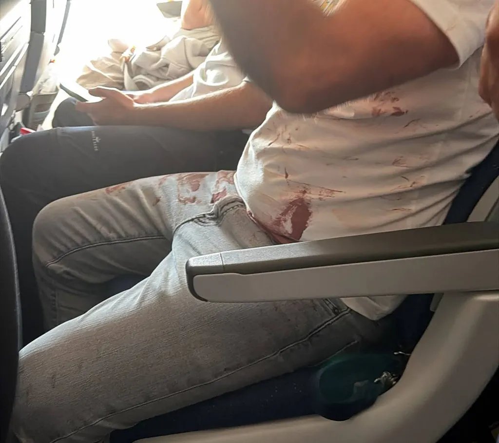 BasilTheGreat's tweet photo. 🚨BREAKING: Passengers have stormed the cockpit of a plane after the CO-PILOT began brutally stabbing the PILOT in what is believed to be an attempted hijacking

Flight FZ1073, carrying 180 people, was flying to Ben Gurion Airport from Dubai

As the attack happened the plane dropped 15,000 feet

The international emergency alert was followed by a 7500 code, meaning a hijacking or unlawful interference, as it entered Jordanian airspace.

A passenger told news media after the plane made an emergency landing at Saudi’s Tabuk Airport: “We heard screams on the plane.

The woman – who was not identified – said Israeli passengers stormed the cockpit to help restrain an attacker along with members of the crew.

She added: “We prayed. There were also moments when we thought we weren’t going to make it out alive.”