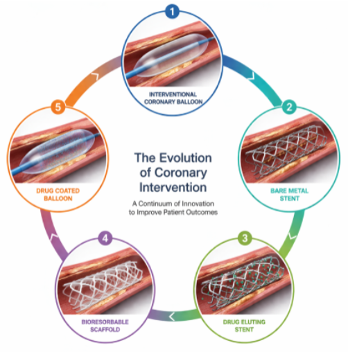 PCRonline's tweet photo. Back to the future - Lessons from past management of atherosclerotic coronary vascular disease that can guide contemporary PCI practice  

📺 & 📰https://t.co/6CCrmMoLpU

Reflecting on historical perspectives, this session replay imparts valuable lessons to guide PCI practice today: 
🟣 best practices in vessel preparation
🟣the significance of DES
🟣a pathologist’s insight into mechanisms of PCI failure to improve patient outcomes.

Physician team: @twj1974 , Patrick W. Serruys, @mc_morice, Bruno Scheller, @Antocol17,  @AlokeFinn,  Joanna Wykrzykowska

#interventionalcardiology #EuroPCR