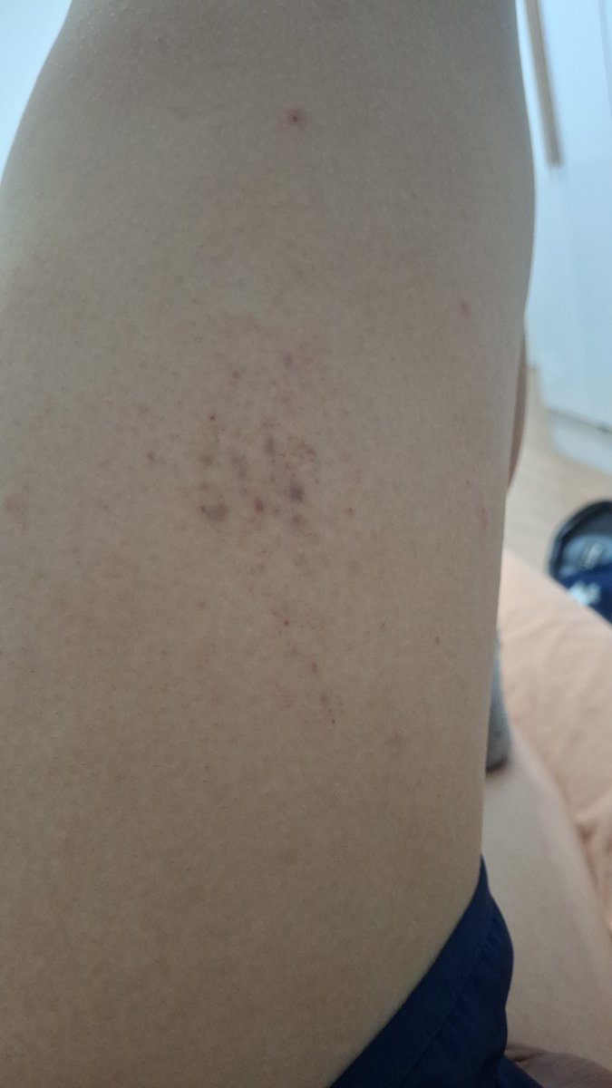 GeorgiaFoddaci's tweet photo. Eu me esmurrei até minha coxa ficar roxa, arranquei as cortinas da minha casa. EU NÃO TO BEM, E ELE FEZ ISSO COMIGO, ELE ME DEIXOU PQ SIM, E EU SOU O CULPADO? EU SOU O VILÃO DESSA MERDA? https://t.co/gtMWpNUiHA