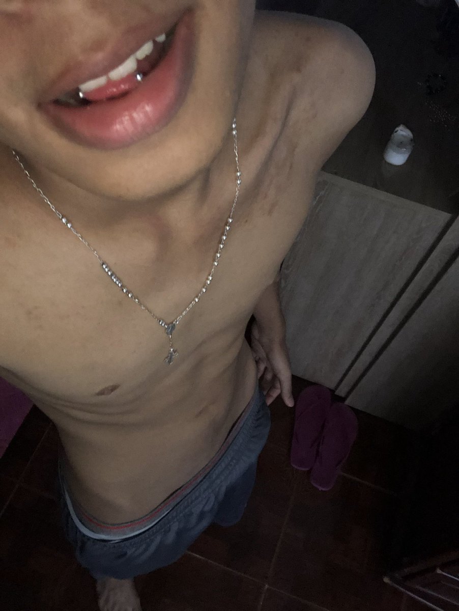 LuisValenciaVix's tweet photo. https://t.co/i520E9K9ja 😈 https://t.co/aG2qBG8gHf