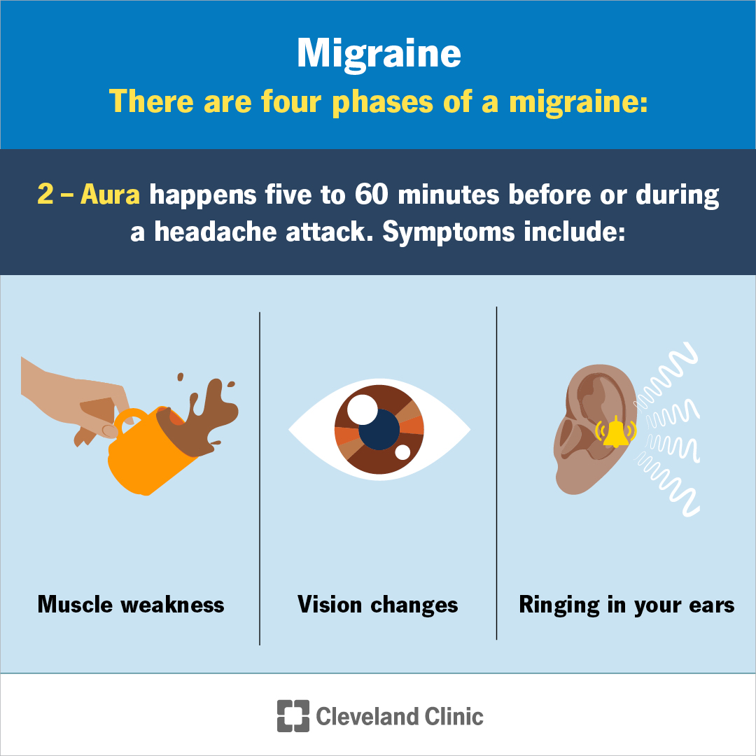 ClevelandClinic's tweet photo. A migraine is much more than a bad headache. It can cause debilitating, throbbing, one-sided head pain that can leave you in bed for days. Movement, lights, sounds and other triggers may cause symptoms like fatigue, nausea, vision changes, irritability and more. A healthcare provider can help you manage symptoms so migraines don’t take over your life.
