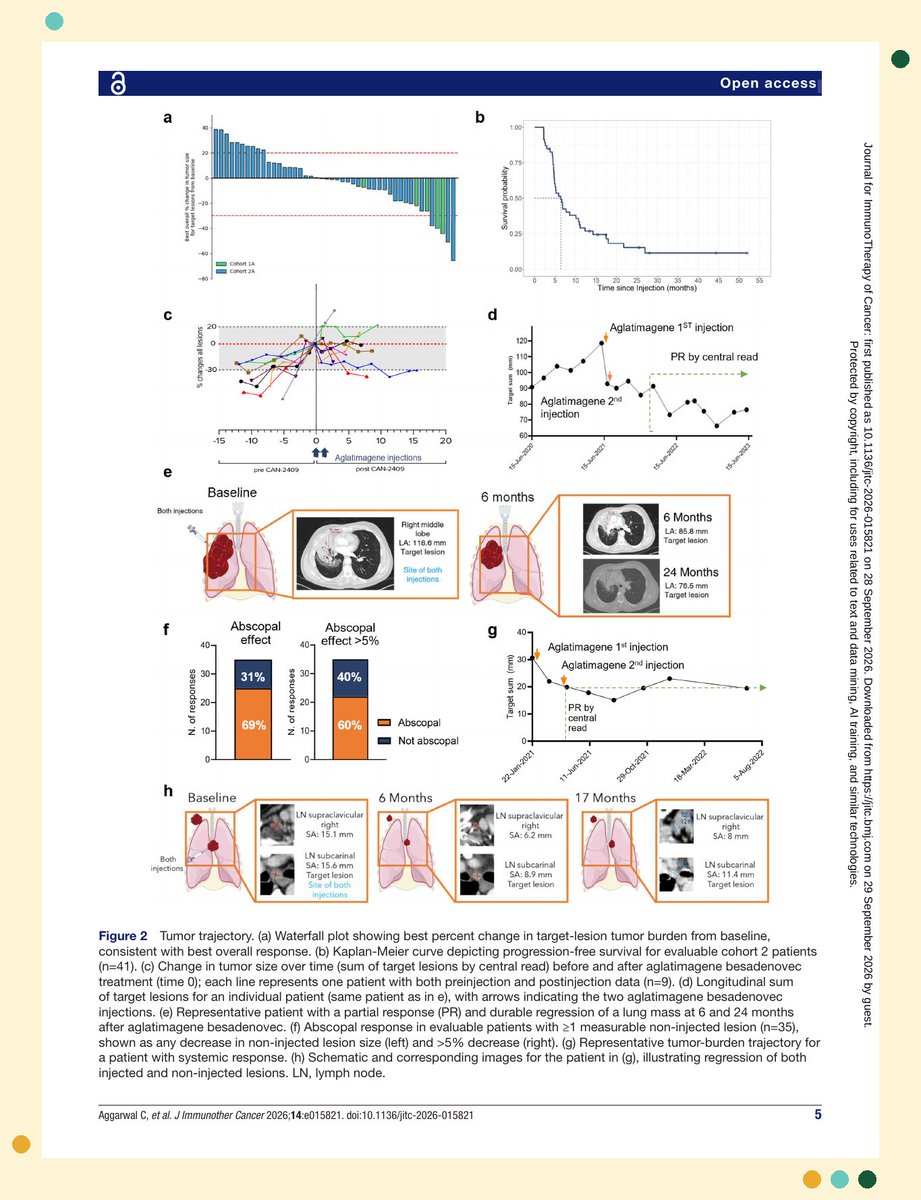 mgonzalezvelMD's tweet photo. 24.5-month median OS in ICI-refractory NSCLC with an oncolytic virus.

CAN-2409 + valacyclovir by @CharuAggarwalMD @StermanDaniel Paul Tak on @jitcancer.

Take: ORR 10.9%, DCR 71.7%; mOS 24.5 mo per-protocol (14.3 mo safety population, n=73).

Activity post-PD1 disease, but logistically intratumoral therapy does not reach most patients.

Any ideas to make intratumoral therapies more feasible? @OncoAlert

#LCSM #thoraciconcology