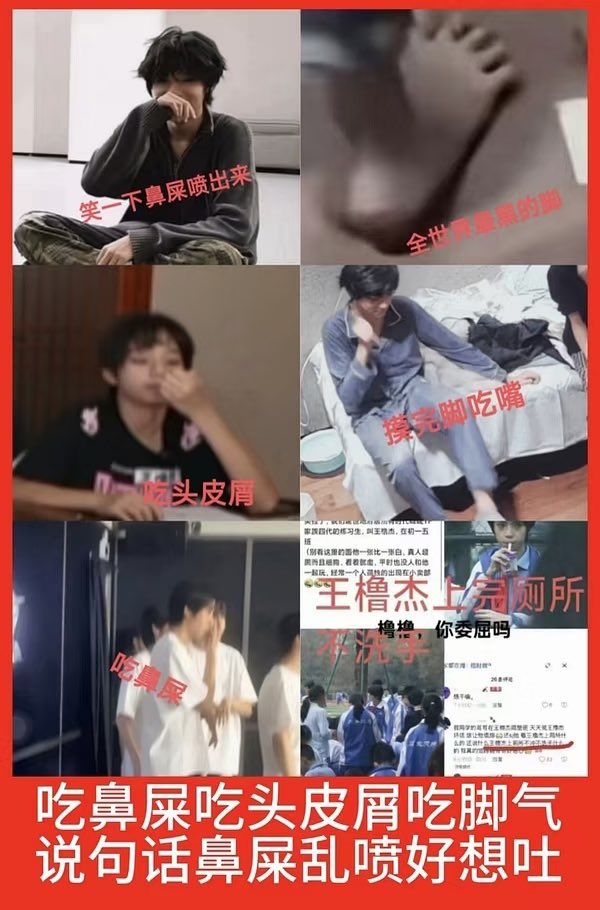 kjgp5j's tweet photo. 屎肛丝喂养指南 先对王橹杰肛周进行局部麻醉，充分暴露痔核。外痔部分沿边缘做V形切口，逐层剥离皮下曲张静脉团；内痔用 专用丝线结扎根部阻断供血，再将多余痔体完整剪除。处理干净切段的疮焯水去腥，冰糖炒出糖色翻炒上色，搭配葱姜八角焖煮。慢炖一小时后肉质软糯，满满胶原蛋白，浓稠酱汁裹住菜花 https://t.co/D5pZj4IMkB