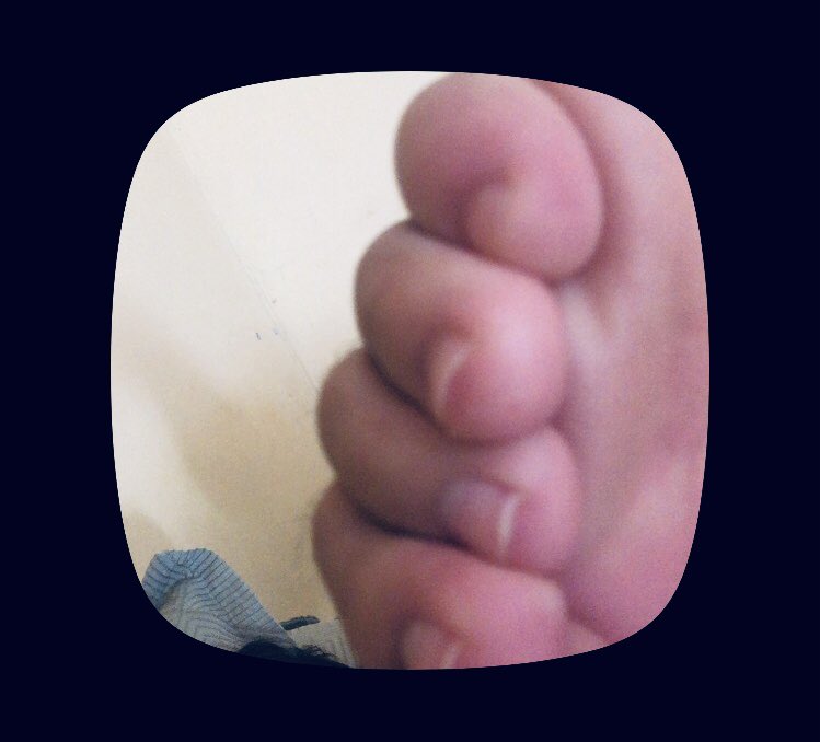 heyantonio_'s tweet photo. Alguém quer compra pack do meu pé 🦶 
#pes https://t.co/IiXTZe8rju