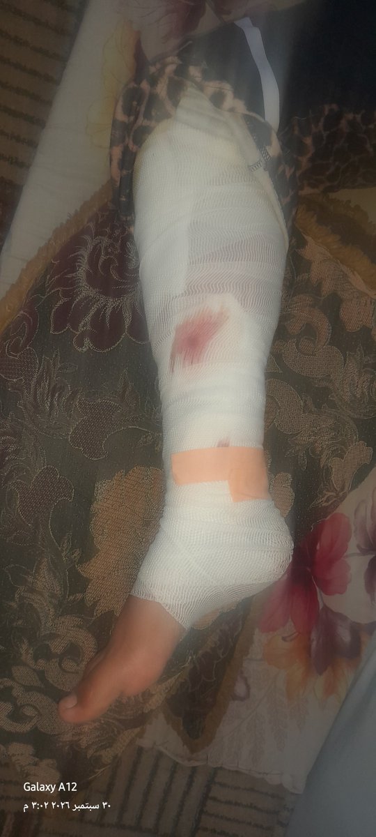 MansourMan7091's tweet photo. This is where my wife’s and my ordeal begins. Thank God, she successfully came through the surgery; however, if I cannot raise the funds to procure the necessary medication and medical supplies, her condition will deteriorate. Please contribute, even a small amount🙏
@oliveegirl https://t.co/kzsMQYX39b