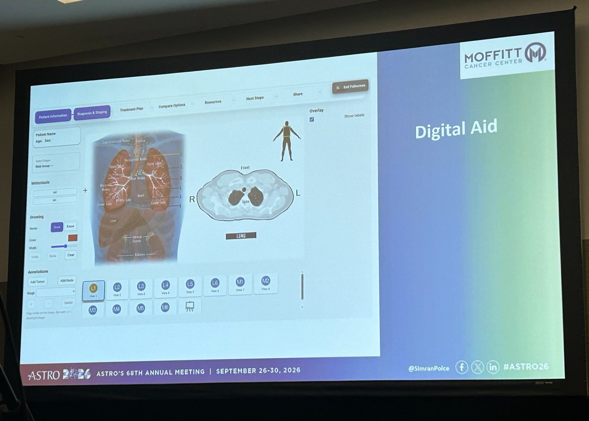 MoffittNews's tweet photo. From #ASTRO26 this morning, Simran Polce, MD (@SimranPolce), shares findings on a patient-centered visual communication tool for telehealth that improved patient understanding and the virtual consultation experience, highlighting the potential of digital tools to strengthen communication in radiation oncology. #MoffittASTRO26