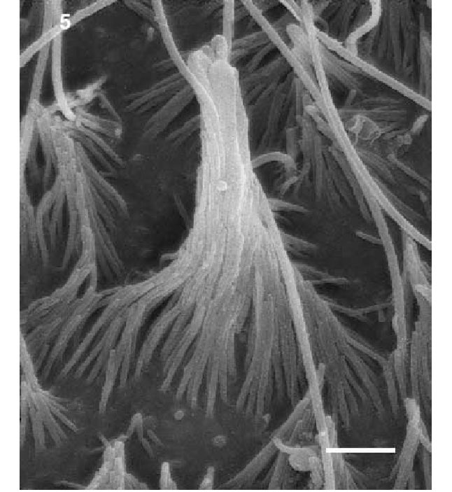 manorlaboratory's tweet photo. I was blown away in grad school in 2006 to learn sea anemones have hair cells. Look at these bundles! 🤯

Now, 20 years later, a major advance in PNAS: evidence that cnidarian stinging cells and vertebrate hair cells share an ancient TMC-based mechanosensory toolkit.

https://t.co/xWqfklRRE4

Image credit: Watson, Mire & Hudson, Hearing Research (1997), “Hair bundles of sea anemones as a model system for vertebrate hair bundles.”