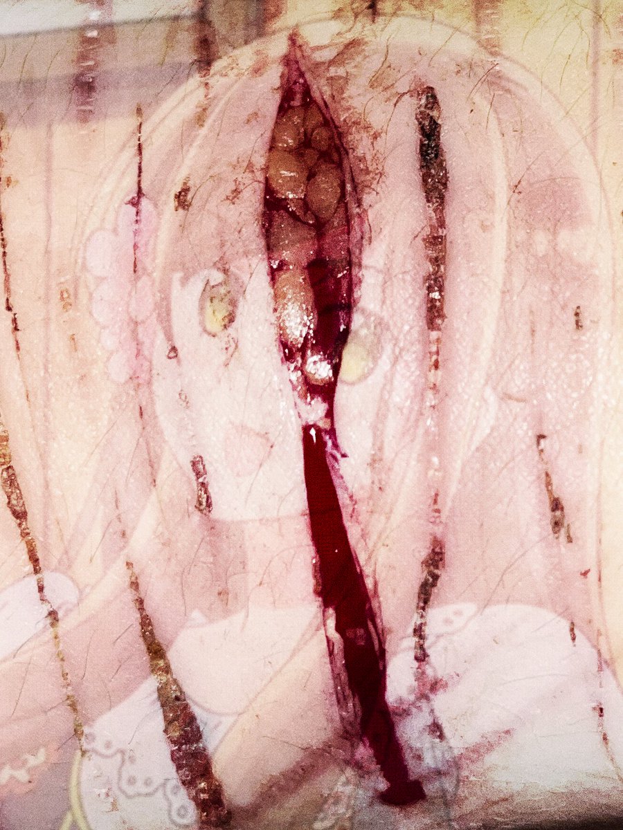 2phungary's tweet photo. 🌟wa
#sh #selfharm #shtwtt #fakeblood #aisfxmakeup #slittwt #988twt https://t.co/M9887rQRzK