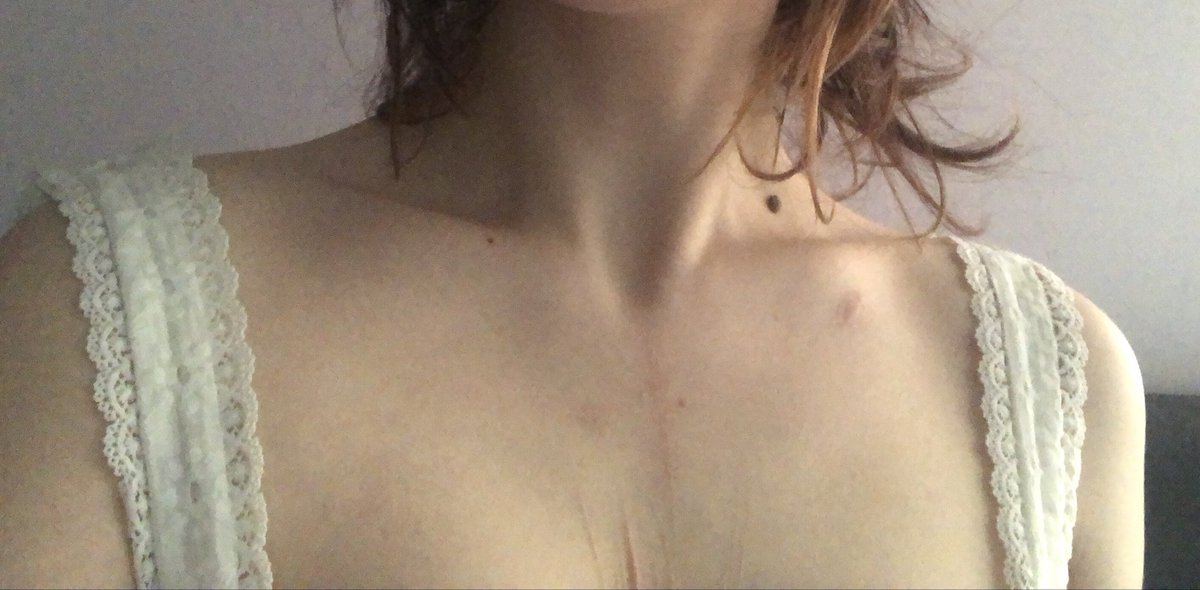 ilovesuamore's tweet photo. Was trying to stand as straight as I could for u guys 

Hey I’m skinnyfat but at least I’m skinny!? Kind of? Hoping https://t.co/04qo5OQu7w
