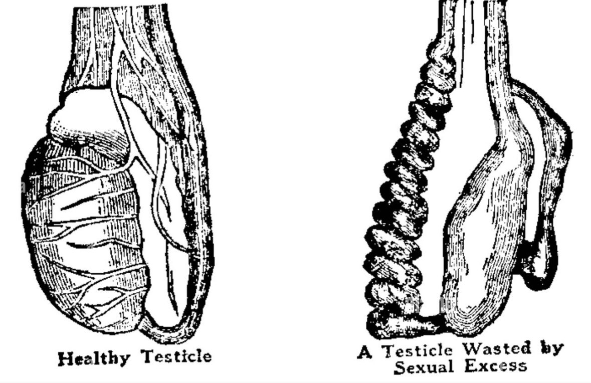 cvcwellness's tweet photo. It's estimated that one ejaculation depletes around:

• 5 mg of Zinc (that's nearly 50% of your daily needs)

• A substantial amount of magnesium, selenium, and B12

Over time, frequent ejaculation without proper nutrition can lead to deficiencies and shit energy, mood AND fertility.

This is why semen retention (release no more than once a week is a solid rule of thumb), paired with high-mineral raw nutrition, is powerful for rebuilding masculine energy.