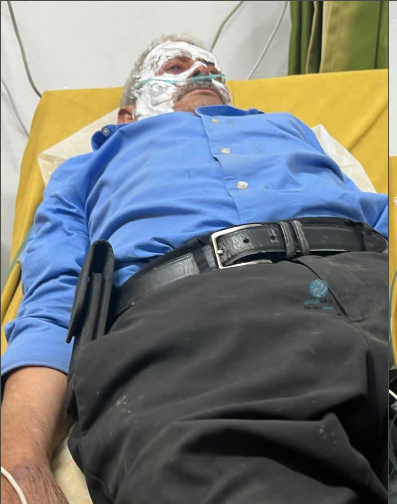 IhabHassane's tweet photo. BREAKING: Israeli settler terrorists assaulted and pepper-sprayed Jameel Alnasan, a 90-year-old American citizen, in the village of Al-Mughayyir in the West Bank. https://t.co/qD3Wj8RiJf